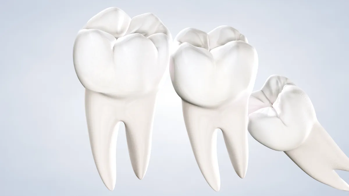 What Are Wisdom Teeth (Third Molars)?